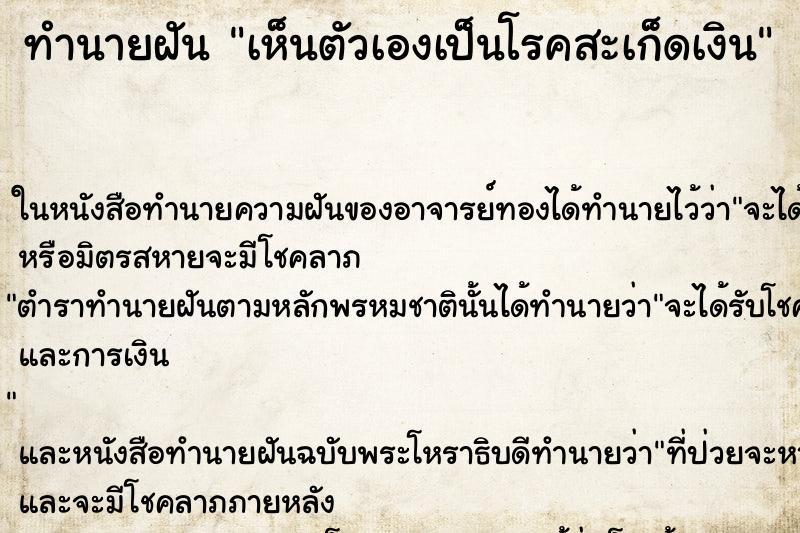 ทำนายฝัน เห็นตัวเองเป็นโรคสะเก็ดเงิน ทำนายฝัน เห็นตัวเองเป็นโรคสะเก็ดเงิน