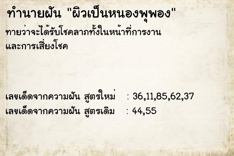 ทำนายฝันผิวเป็นหนองพุพอง ทำนายฝันทำนายฝันผิวเป็นหนองพุพอง