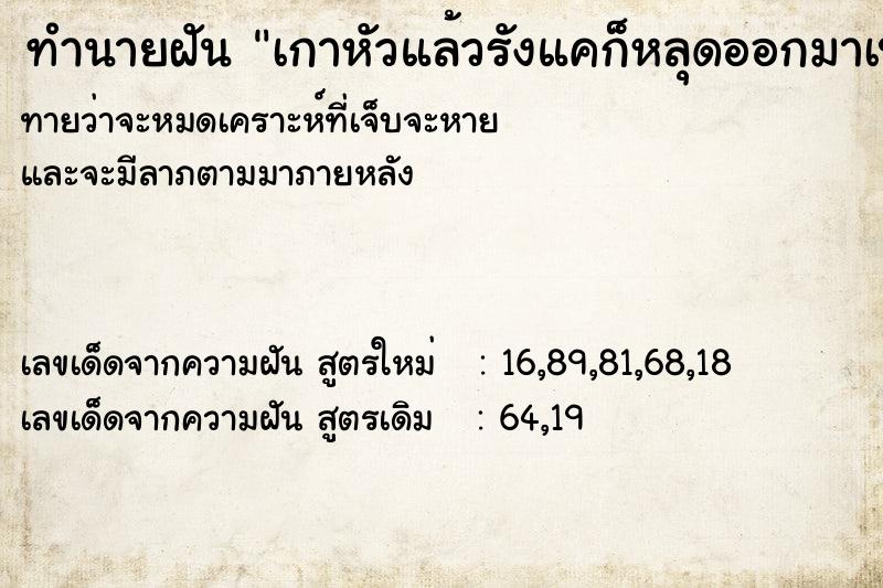 ทำนายฝันเกาหัวแล้วรังแคก็หลุดออกมาเป็นแผ่นจนเต็มกำมือ ทำนายฝันทำนายฝันเกาหัวแล้วรังแคก็หลุดออกมาเป็นแผ่นจนเต็มกำมือ