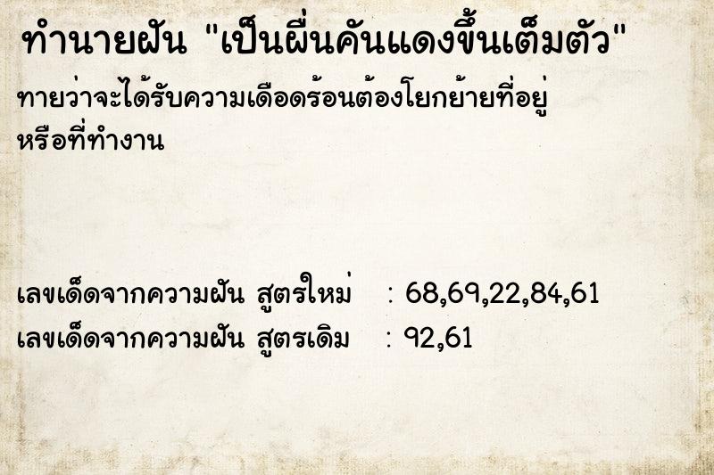 ทำนายฝันทำนายฝันเป็นผื่นคันแดงขึ้นเต็มตัว