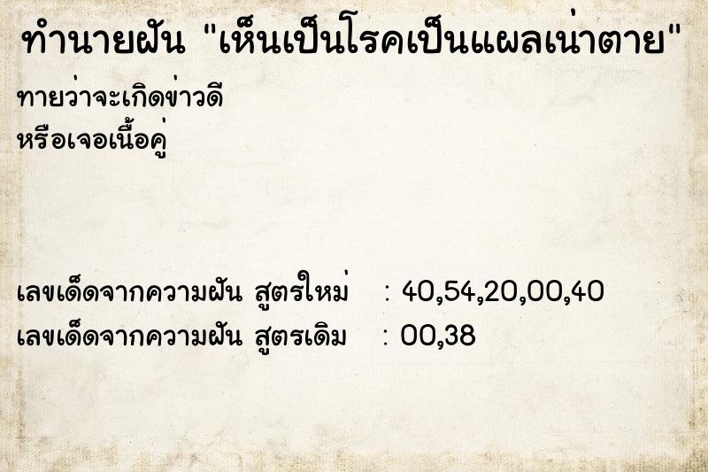 ทำนายฝันทำนายฝันเห็นเป็นโรคเป็นแผลเน่าตาย