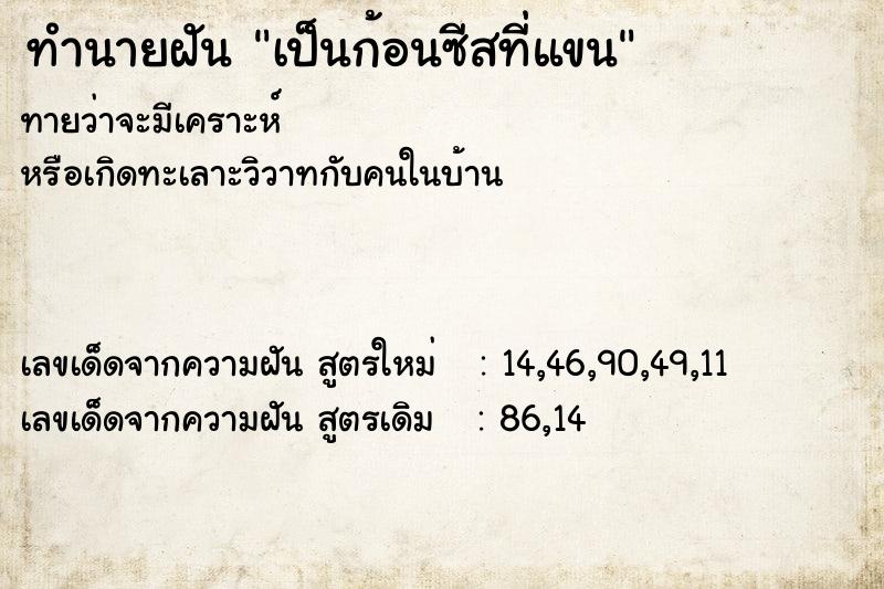 ทำนายฝันทำนายฝันเป็นก้อนซีสที่แขน