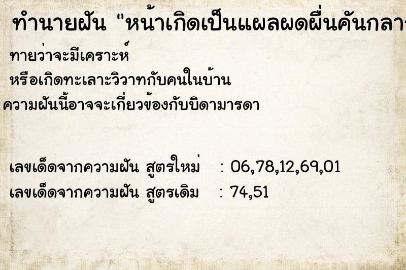 ทำนายฝันทำนายฝันหน้าเกิดเป็นแผลผดผื่นคันกลากเกลื้อน