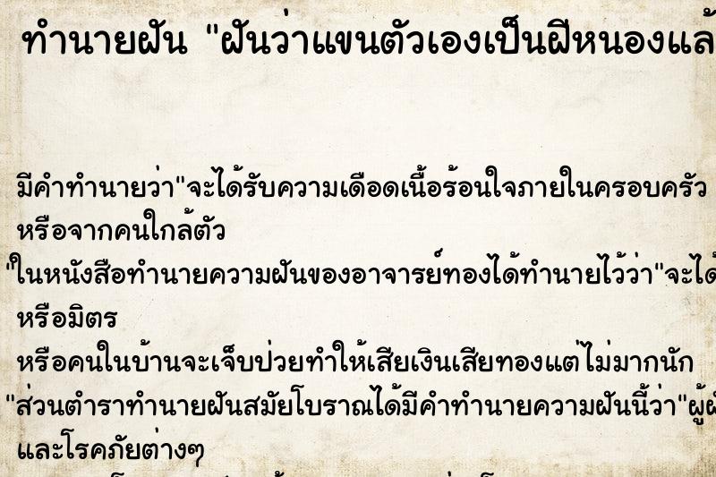 ทำนายฝัน ฝันว่าแขนตัวเองเป็นฝีหนองแล้วมีหนอนออกมา ทำนายฝัน ฝันว่าแขนตัวเองเป็นฝีหนองแล้วมีหนอนออกมา
