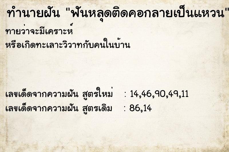 ทำนายฝันทำนายฝันฟันหลุดติดคอกลายเป็นแหวน