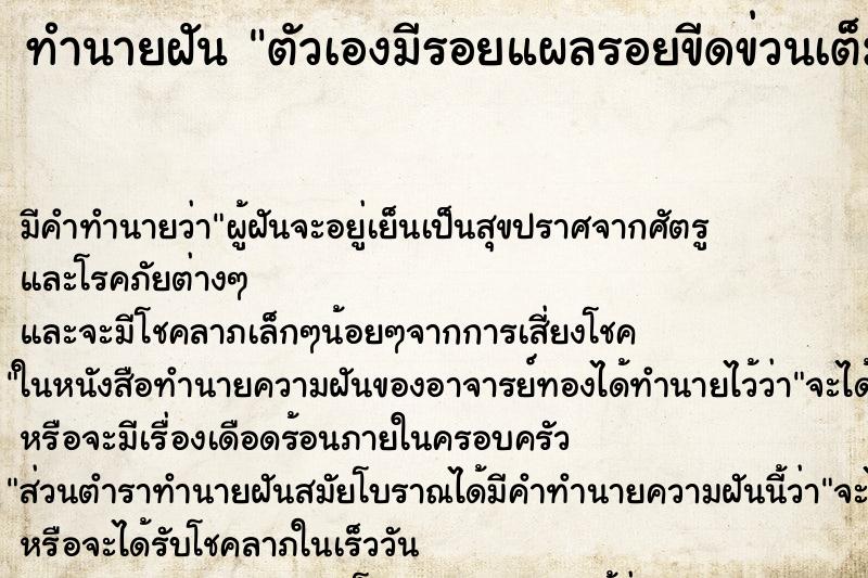 ทำนายฝัน ตัวเองมีรอยแผลรอยขีดข่วนเต็มร่างกาย ทำนายฝัน ตัวเองมีรอยแผลรอยขีดข่วนเต็มร่างกาย