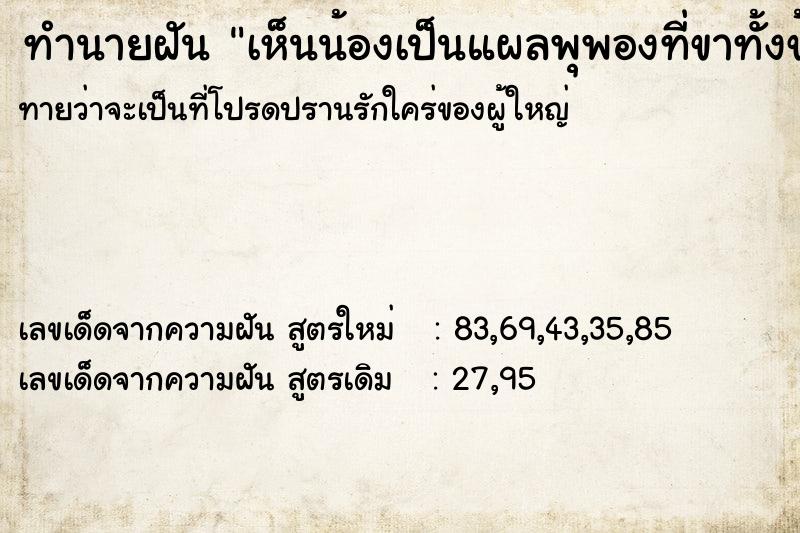 ทำนายฝันทำนายฝันเห็นน้องเป็นแผลพุพองที่ขาทั้งข้าง
