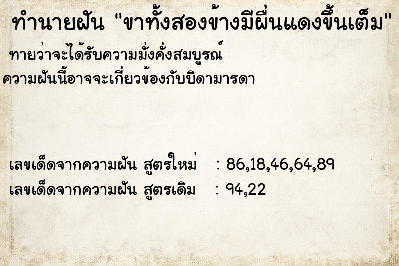 ทำนายฝันขาทั้งสองข้างมีผื่นแดงขึ้นเต็ม ทำนายฝันทำนายฝันขาทั้งสองข้างมีผื่นแดงขึ้นเต็ม