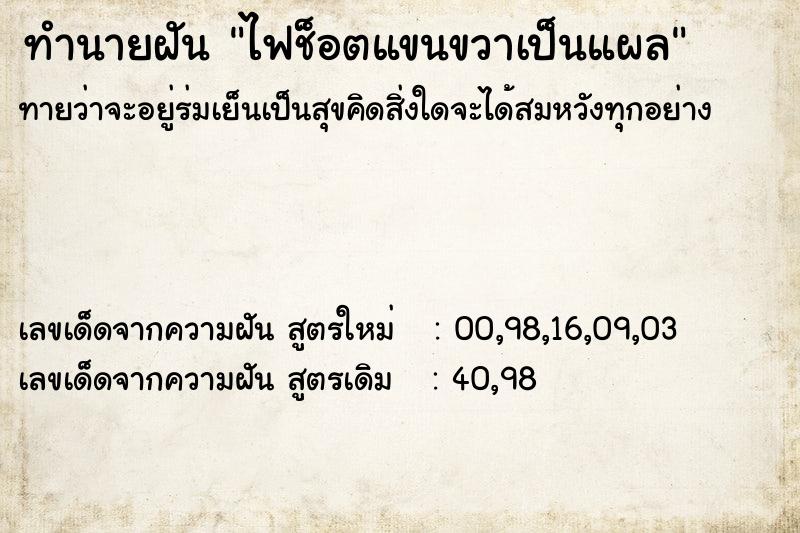 ทำนายฝันไฟช็อตแขนขวาเป็นแผล ทำนายฝันทำนายฝันไฟช็อตแขนขวาเป็นแผล