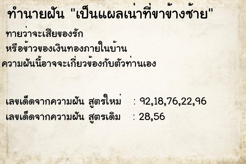 ทำนายฝัน เป็นแผลเน่าที่ขาข้างซ้าย ทำนายฝัน เป็นแผลเน่าที่ขาข้างซ้าย