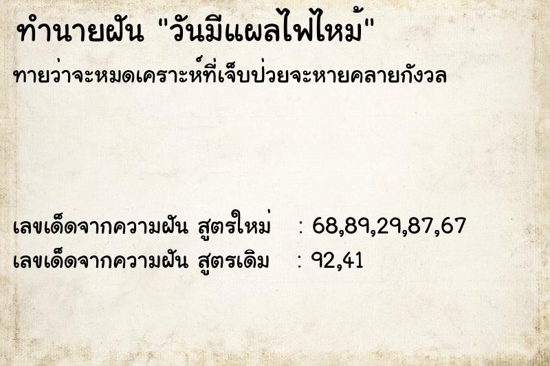 ทำนายฝันวันมีแผลไฟไหม้ ทำนายฝันทำนายฝันวันมีแผลไฟไหม้