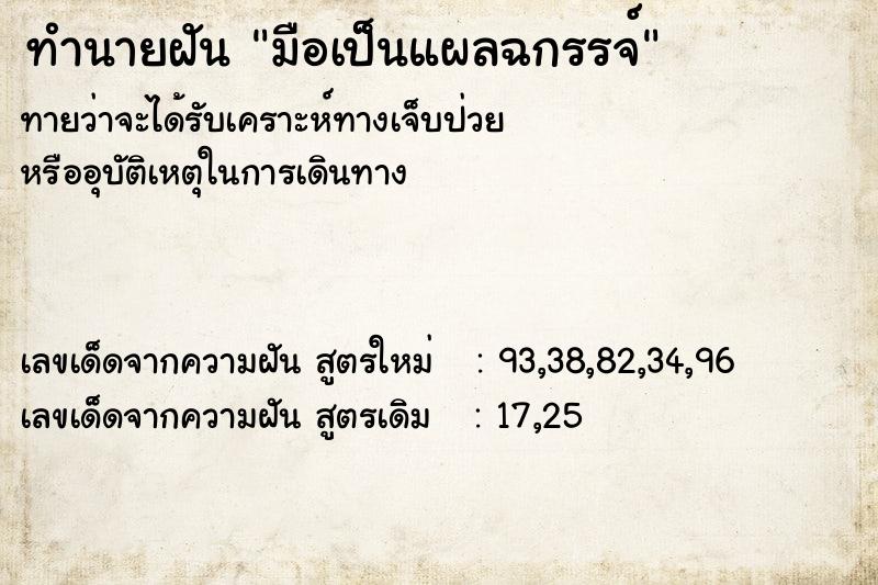 ทำนายฝันทำนายฝันมือเป็นแผลฉกรรจ์