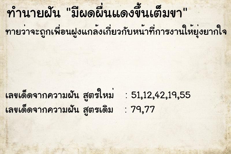 ทำนายฝันทำนายฝันมีผดผื่นแดงขึ้นเต็มขา