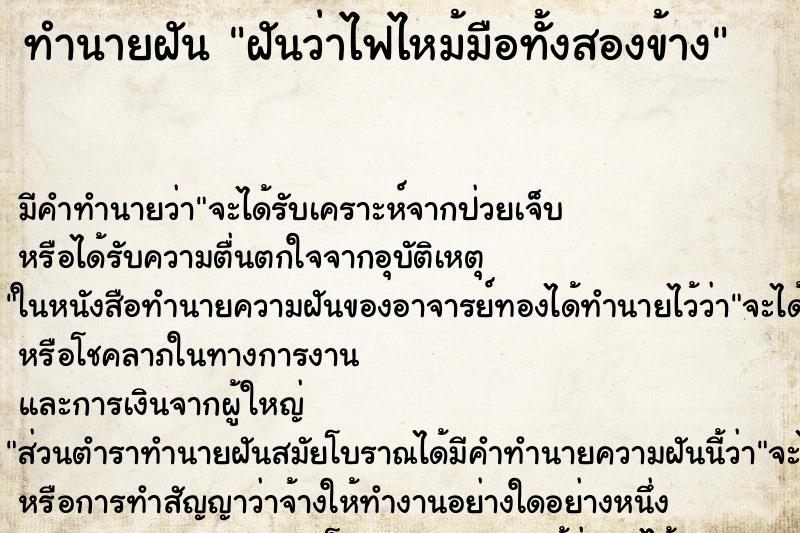 ทำนายฝัน ฝันว่าไฟไหม้มือทั้งสองข้าง ทำนายฝัน ฝันว่าไฟไหม้มือทั้งสองข้าง
