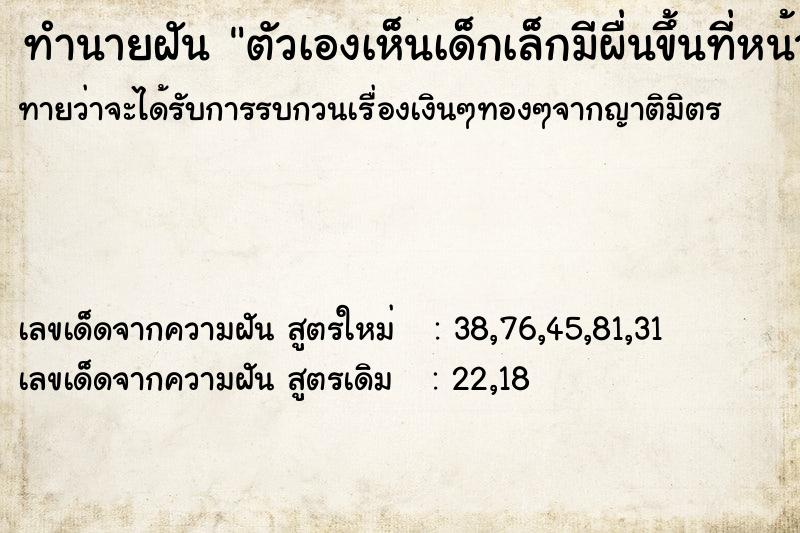 ทำนายฝันตัวเองเห็นเด็กเล็กมีผื่นขึ้นที่หน้า ทำนายฝันทำนายฝันตัวเองเห็นเด็กเล็กมีผื่นขึ้นที่หน้า