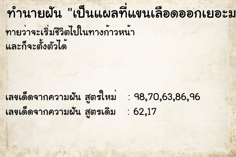 ทำนายฝันทำนายฝันเป็นแผลที่แขนเลือดออกเยอะมาก