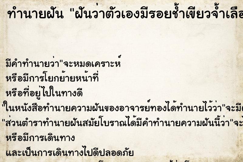 ทำนายฝัน ฝันว่าตัวเองมีรอยช้ำเขียวจ้ำเลือด ทำนายฝัน ฝันว่าตัวเองมีรอยช้ำเขียวจ้ำเลือด