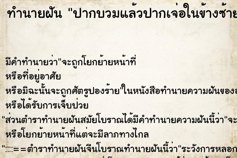 ทำนายฝัน ปากบวมแล้วปากเจ่อในข้างซ้าย ทำนายฝัน ปากบวมแล้วปากเจ่อในข้างซ้าย