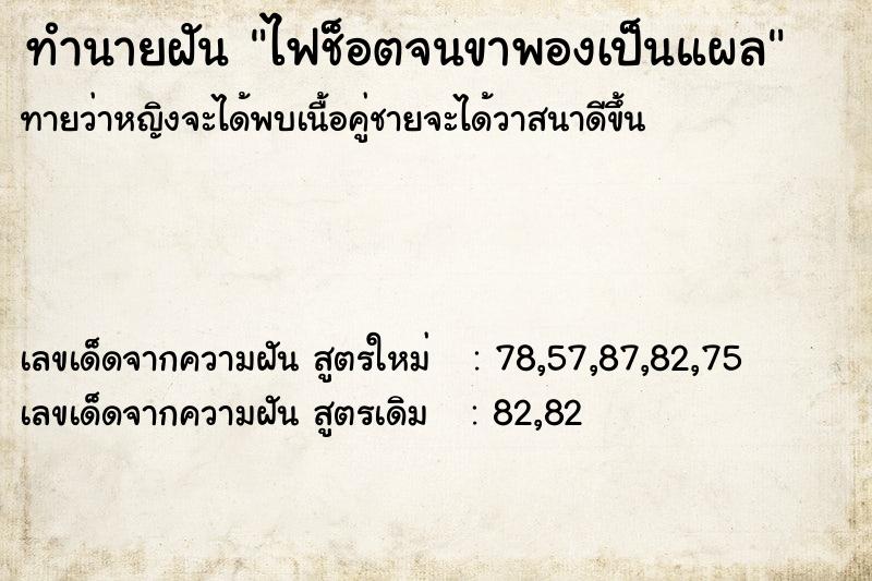 ทำนายฝัน ไฟช็อตจนขาพองเป็นแผล ทำนายฝัน ไฟช็อตจนขาพองเป็นแผล