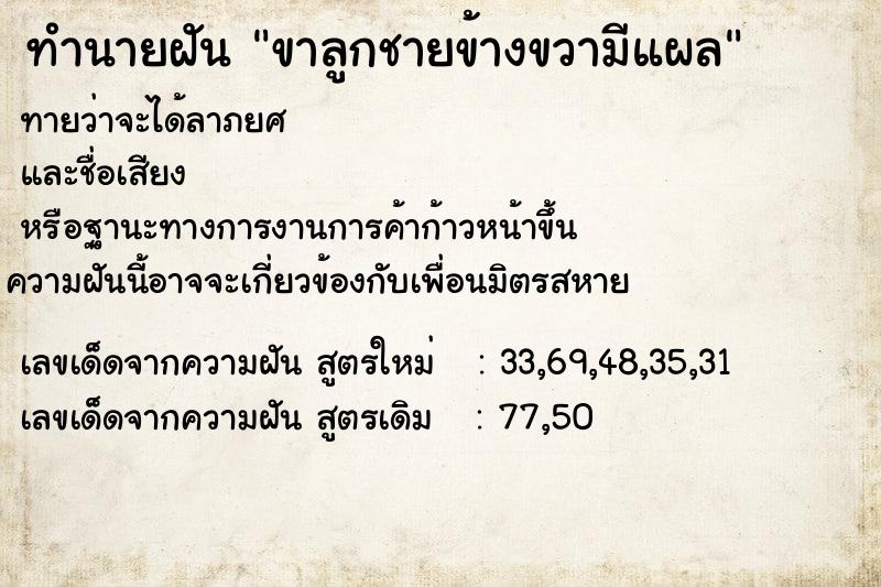 ทำนายฝันทำนายฝันขาลูกชายข้างขวามีแผล