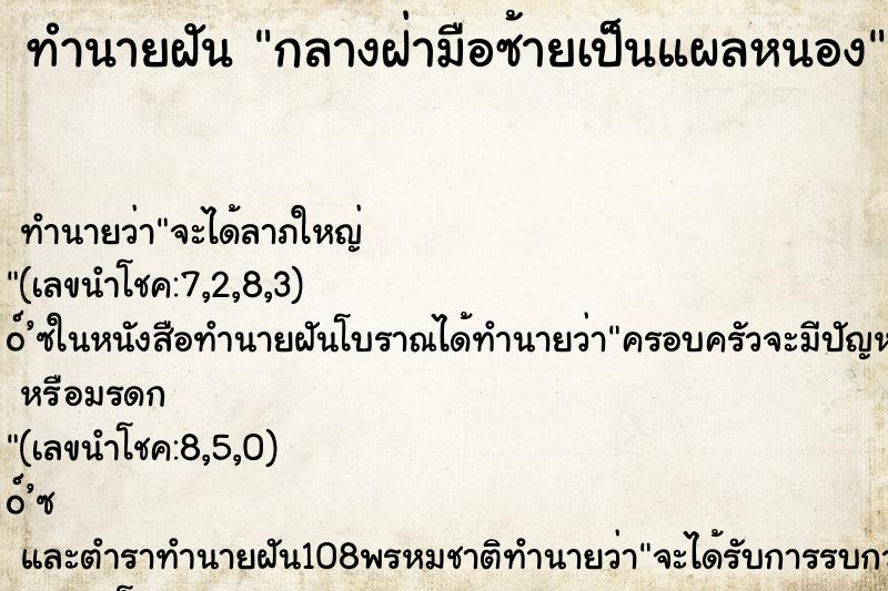 ทำนายฝันกลางฝ่ามือซ้ายเป็นแผลหนอง ทำนายฝันทำนายฝันกลางฝ่ามือซ้ายเป็นแผลหนอง